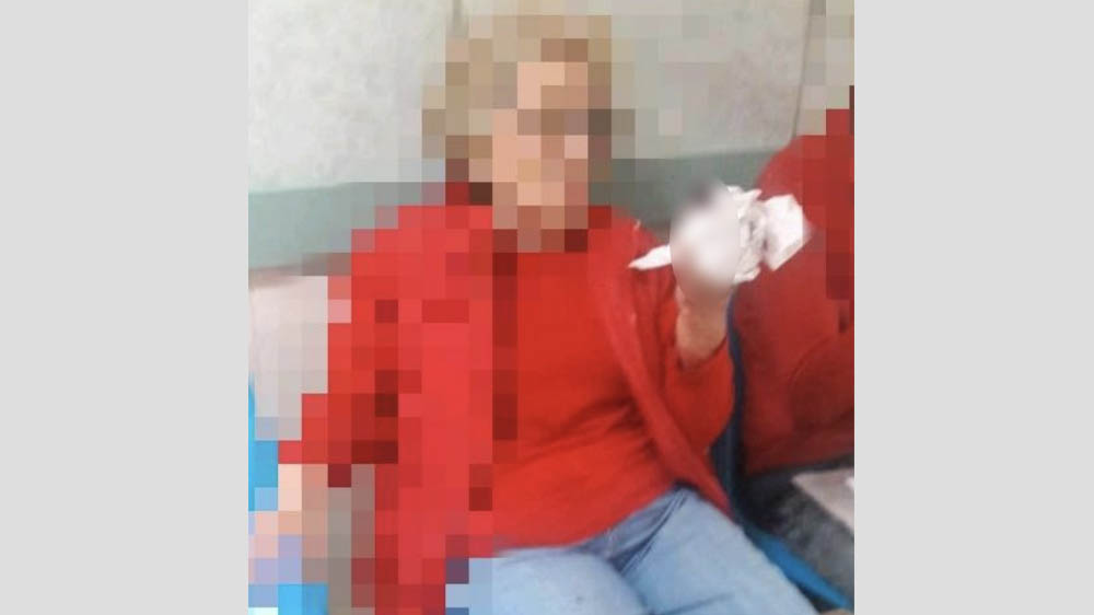 Vagonero le arranca a mujer parte del dedo en el Metro - mujer-dedo-metro-2