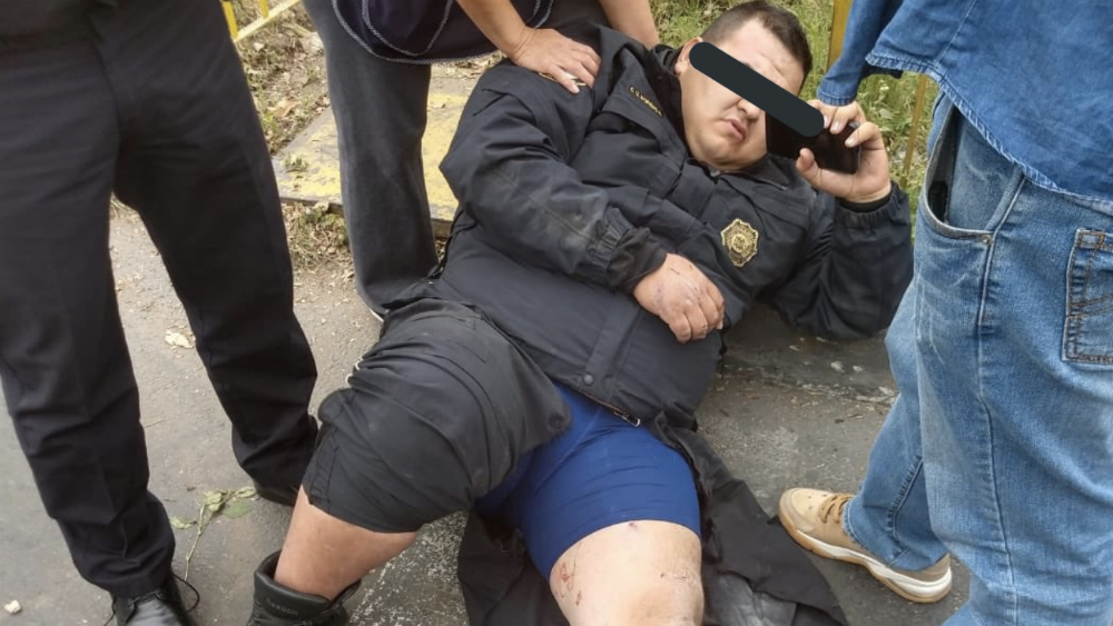 Sale del hospital policía arrollado por delincuentes en moto