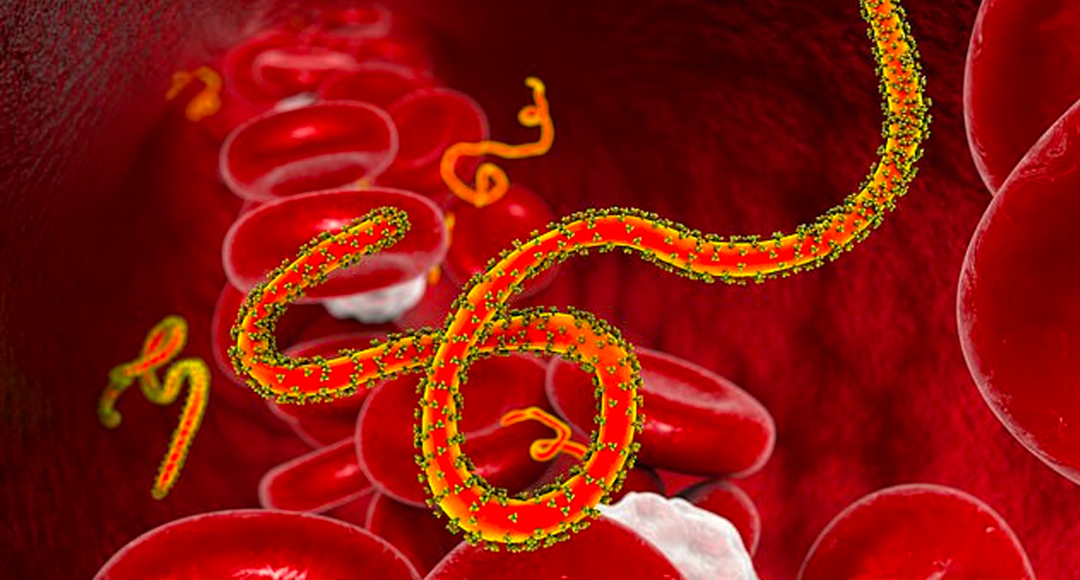 Detectan posible caso de ébola en Suecia