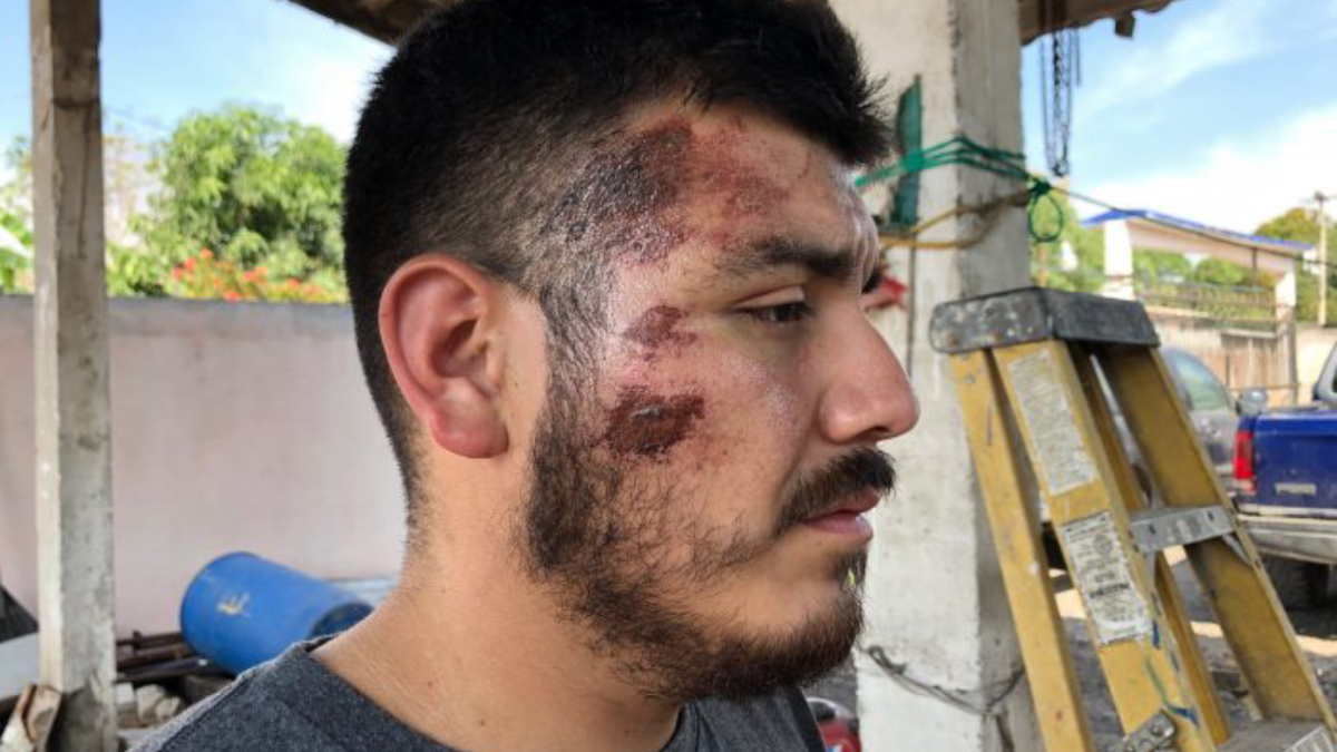 CEDH investiga detención ilegal de familia estadounidense en Veracruz