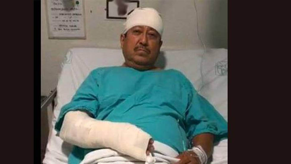 #Video Agreden con bates al periodista Martín Valtierra en BCS