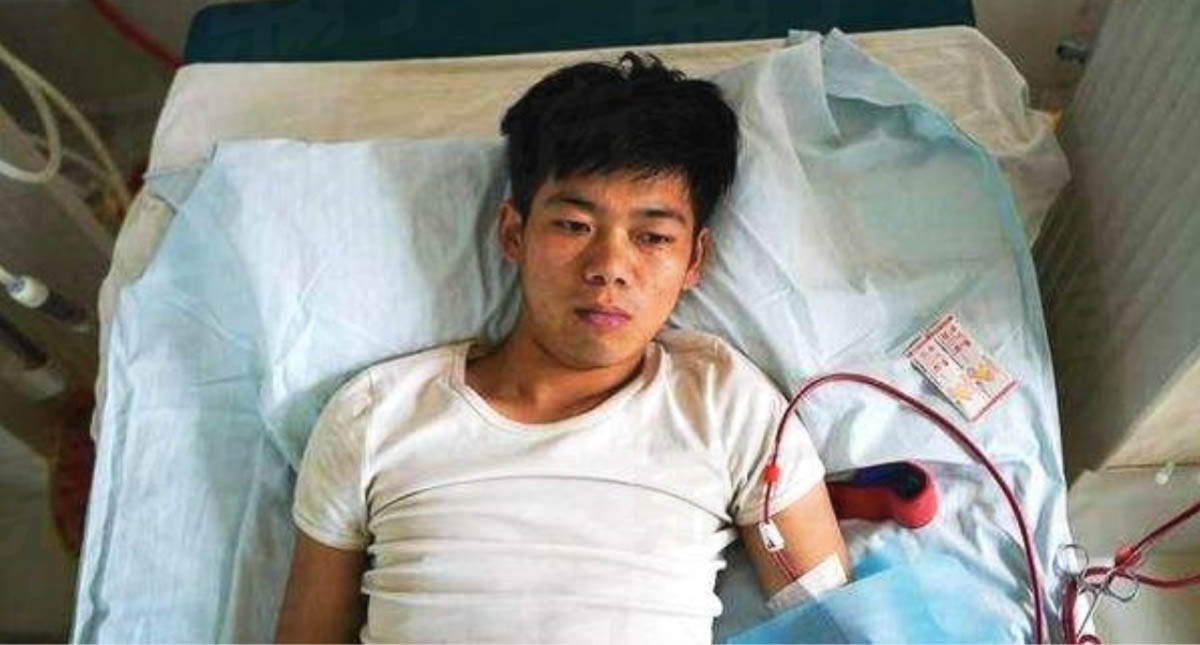 Vendió su riñón para comprar un iPhone y ahora necesita diálisis de por vida