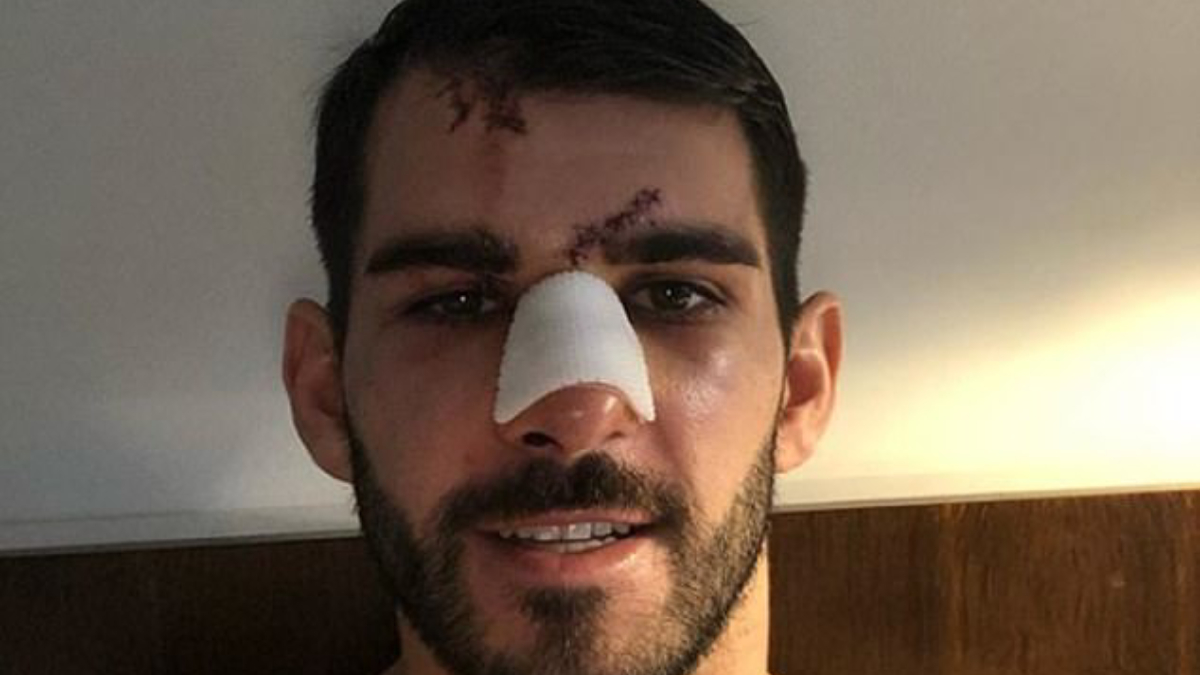 #Video Futbolista termina con el rostro ensangrentado tras ser pisado por rival