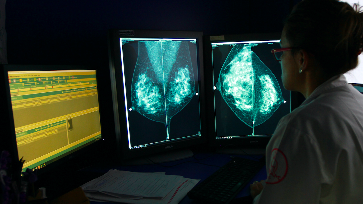 Prevención de cáncer es posible en cuatro de cada 10 casos