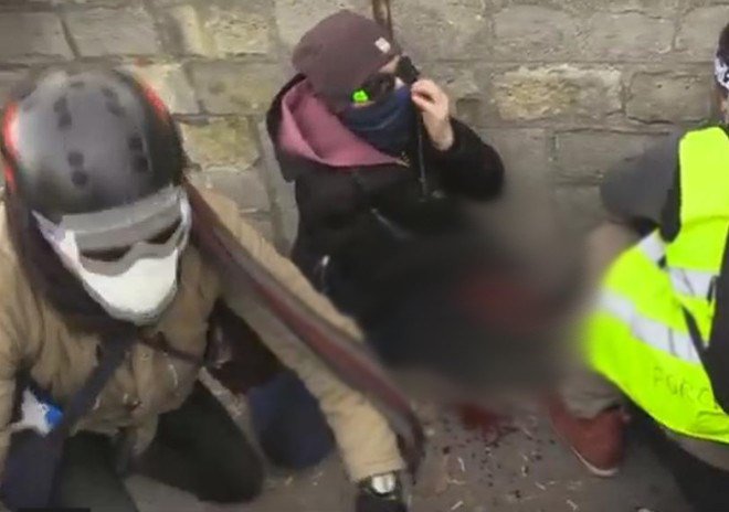 Manifestante pierde mano durante protesta de chalecos amarillos - chalecos-amrillos-mano1