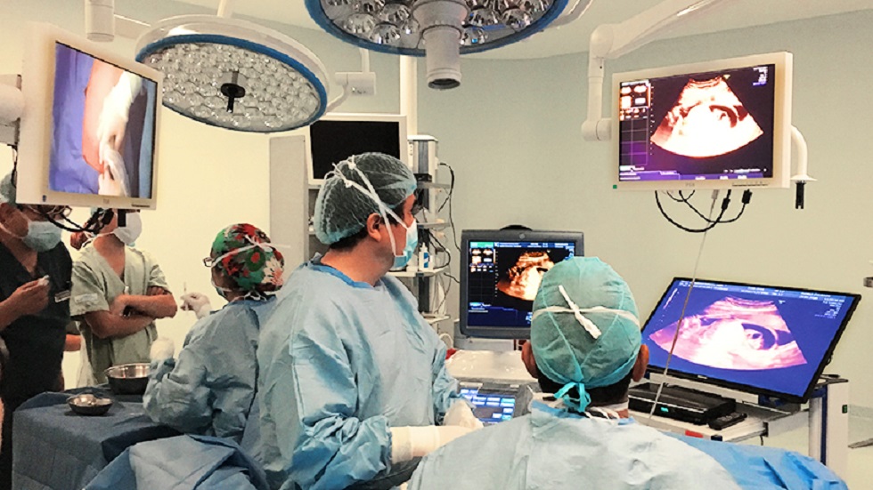 Sacan feto a mujer para operarlo y luego regresarlo al vientre