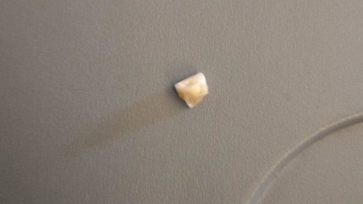 Pasajero encuentra diente humano en comida de Singapore Airlines - diente-humano-vuelo-singapore-airlines-1