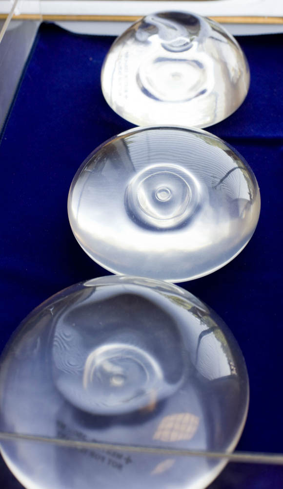 Advierten en EE.UU. relación entre implantes de seno con cáncer - implantes-de-seno