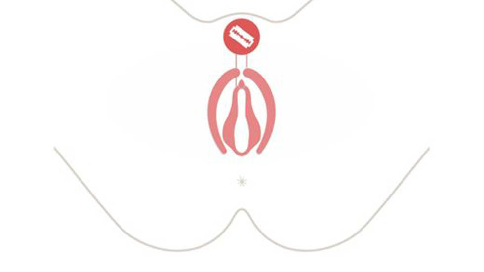 La mutilación genital femenina - infibulacion