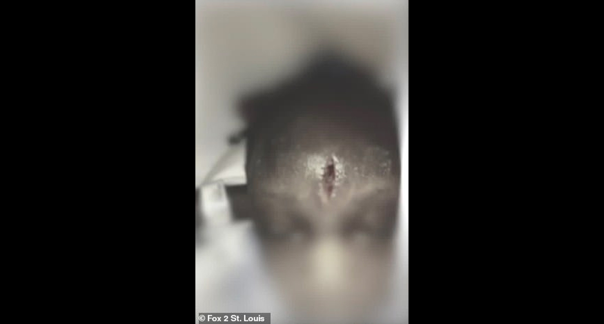 #Video Maestra lanza a niña de tres años y le parte la frente en EE.UU.