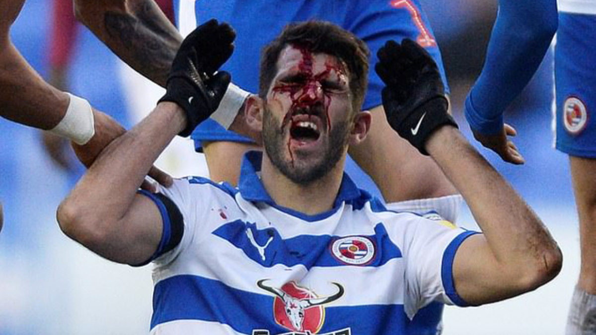 #Video Futbolista termina con el rostro ensangrentado tras ser pisado por rival - nelson-oliveira-1