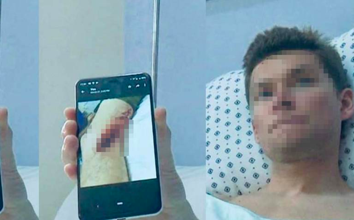 Tiburón ataca a turista en Guerrero