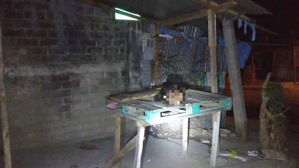 Abandonan restos de mujer desmembrada en Acapulco