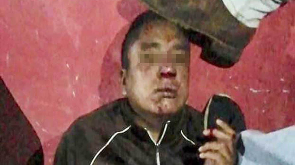 #Video Queman vivo a hombre por presunto intento de secuestro de niño - hombre-antes-de-ser-linchado