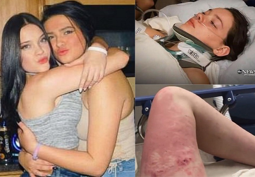 #Video Joven narra entre lágrimas cómo su amiga la empujó de puente - jordan-con-taylor-y-sus-lesiones