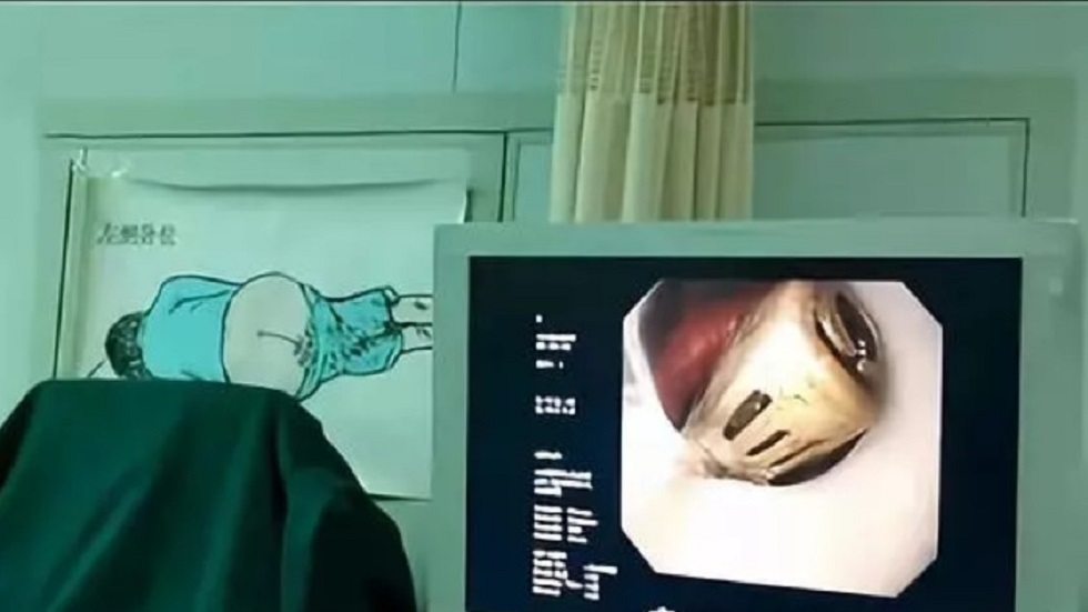 #Video Extraen encendedor a joven que se lo tragó