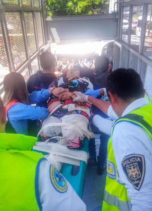 Convoy del Metro amputa pierna a mujer que cayó a vías - mujer-que-cayo-a-las-vias-en-metro-guelatao
