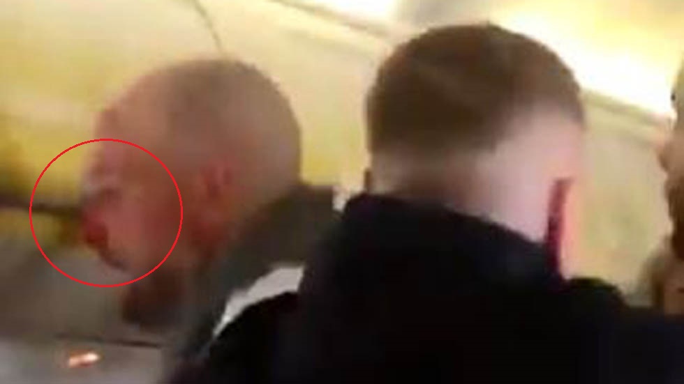 #Video Muerden la nariz a pasajero que quiso detener pelea en vuelo - pasajero-con-la-nariz-sangrando-por-mordedura