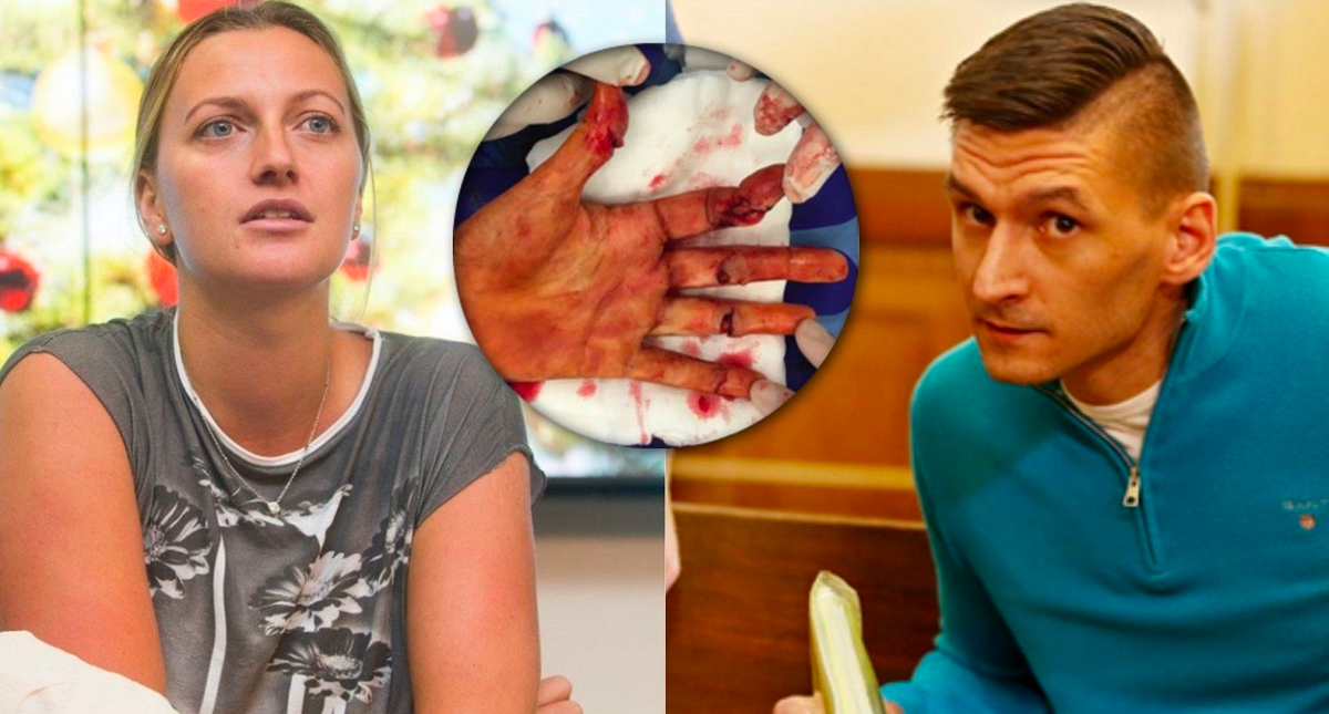 Dan ocho años de cárcel a atacante de la tenista Petra Kvitova