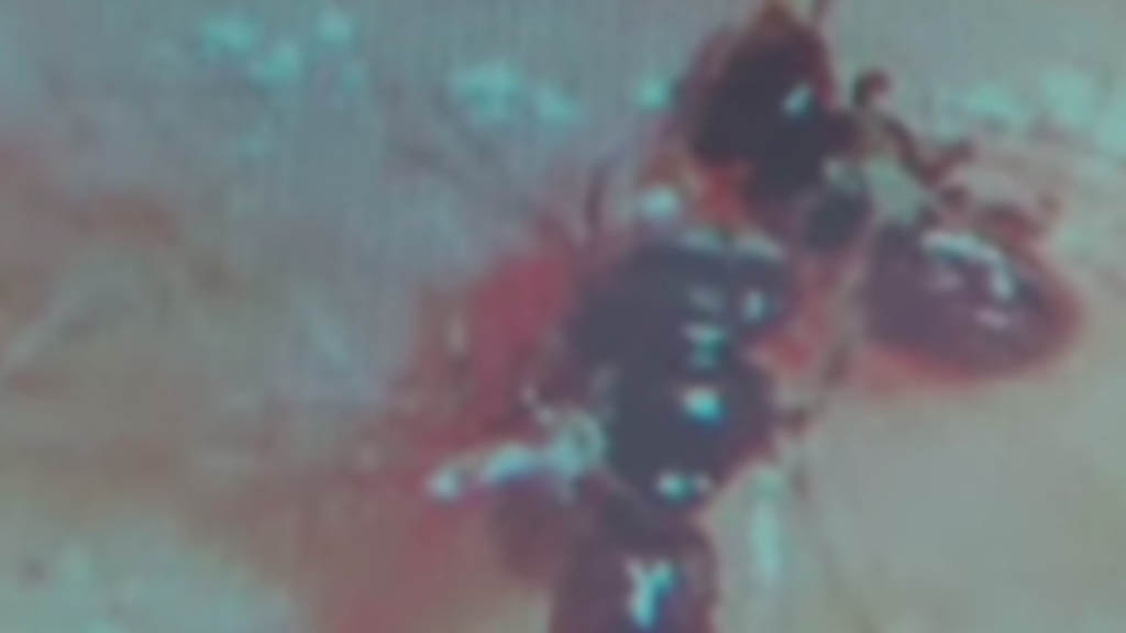 Hallan cuatro abejas viviendo en el ojo de una mujer en Taiwán