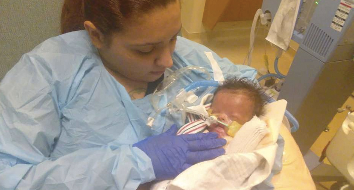 Bebé nace sin piel en Texas - bebe-sin-piel-houston