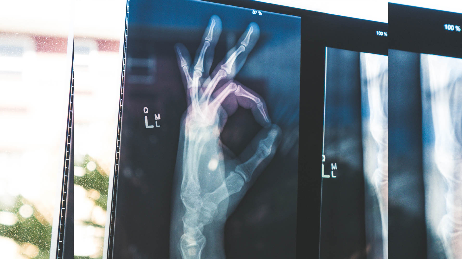 Reto del Día Mundial de la Salud es una cobertura universal para 2030