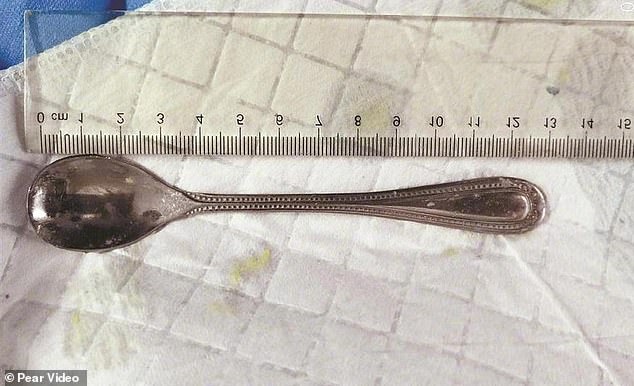 #Video Mujer se traga una cuchara de acero inoxidable en China - cuchara-mujer-china