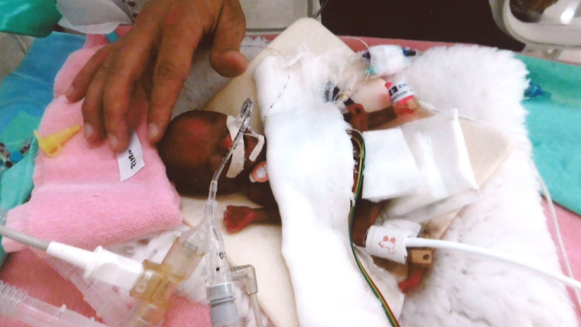 A punto de salir del hospital el bebé más pequeño del mundo - ryusuke-sekiya-bebe-mas-pequeno-del-mundo-2