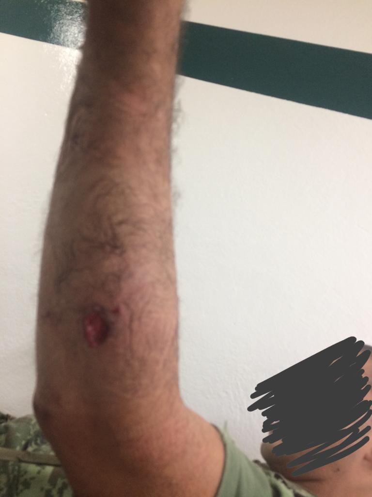 Dos militares heridos tras enfrentamiento con hombres armados en Michoacán - whatsapp-image-2019-04-02-at-104009-pm-1