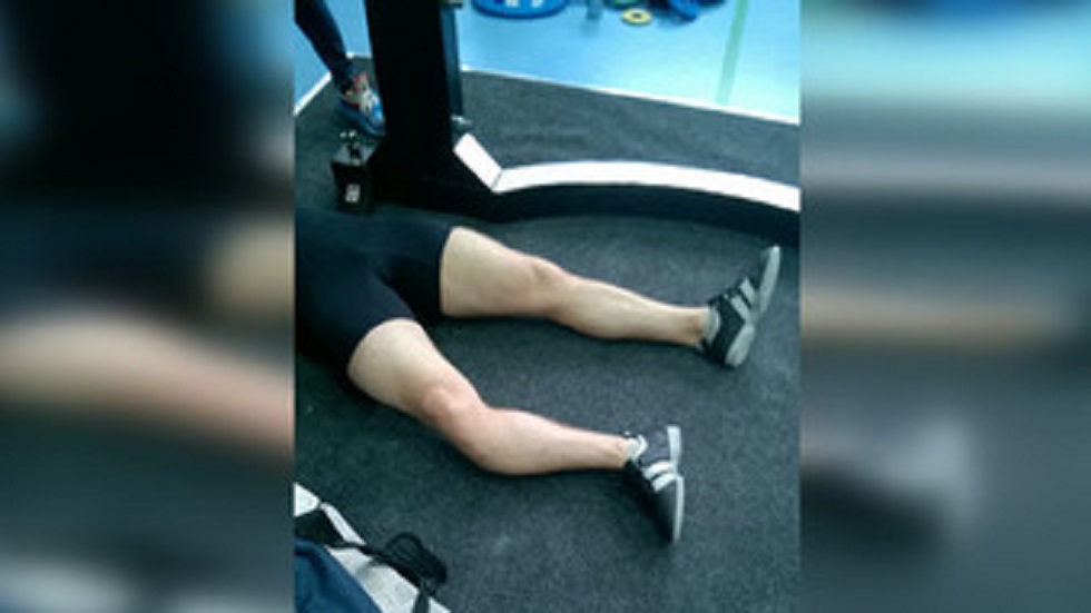 #Video Deportista se rompe la pierna al cargar pesa de 250 kg - fractura-de-pierna-de-deportista