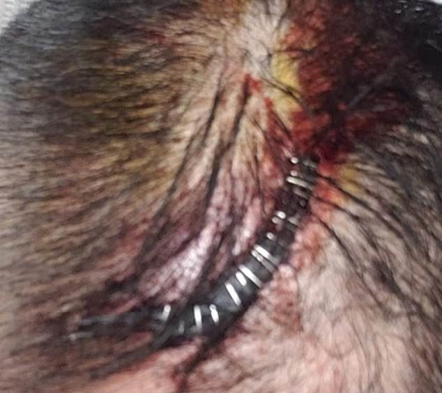 #Video Jóvenes golpean a hombre para robarle en Nueva York - grapas-que-le-pusieron-a-wong