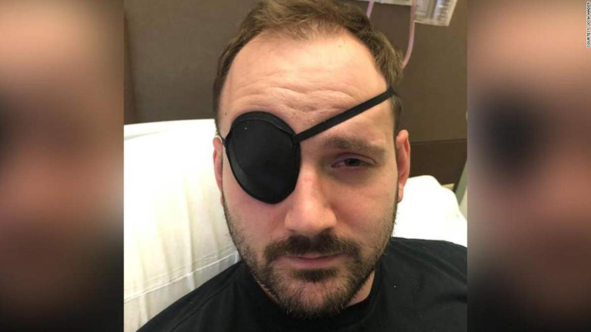 Hombre sufre derrame cerebral por tronarse el cuello