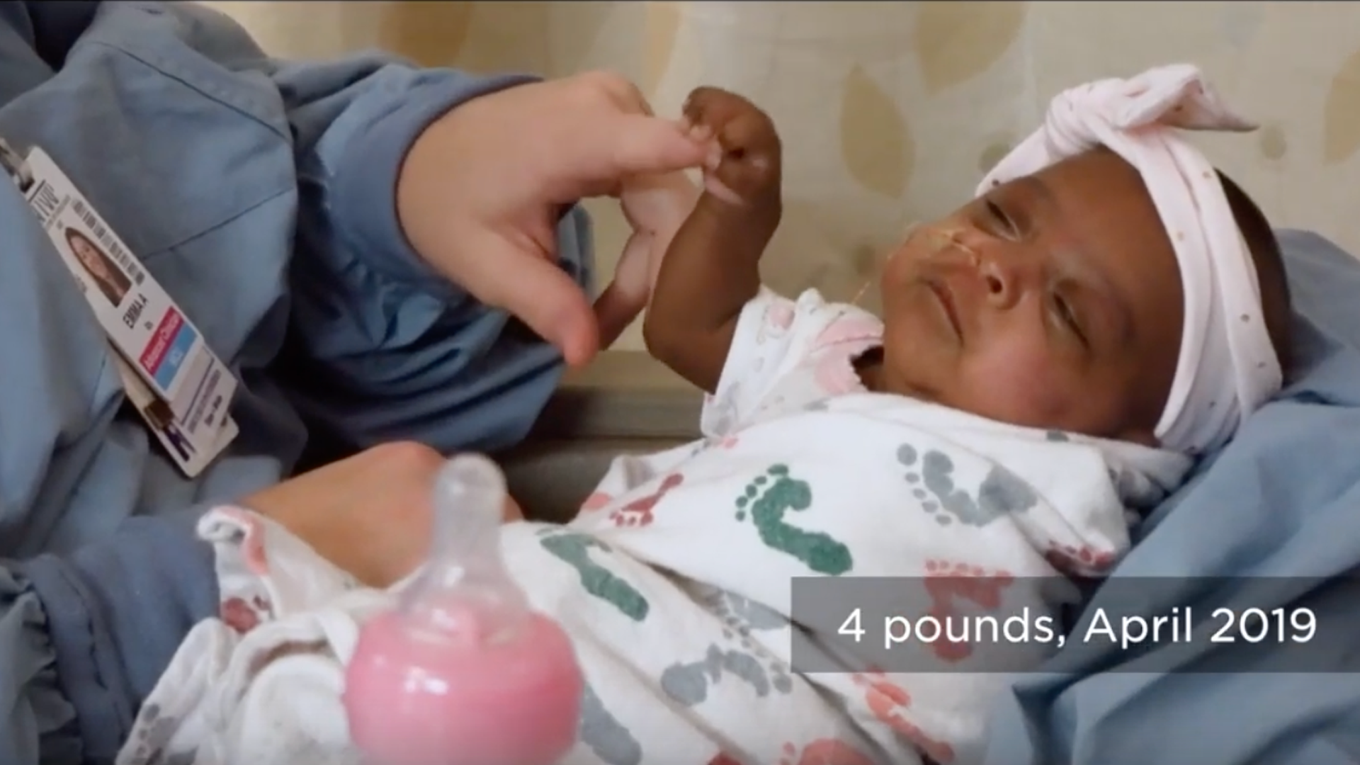 La bebé más pequeña del mundo nace en EEUU: pesó lo mismo que una manzana