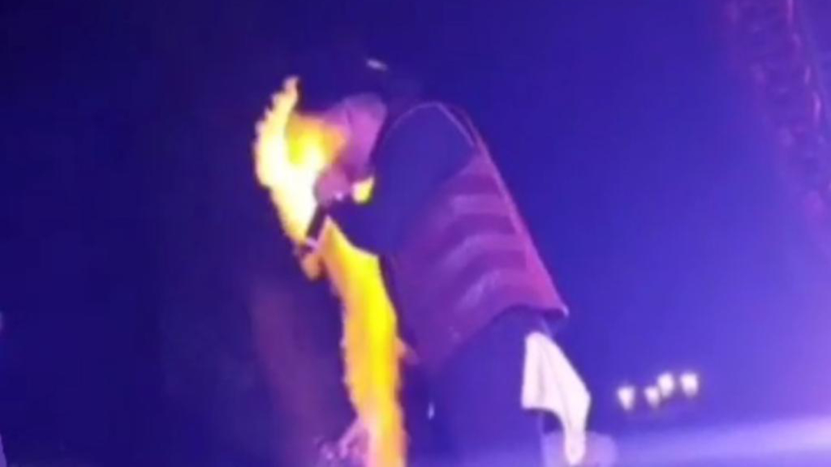 #Video El Gallo Elizalde sufre quemaduras de segundo grado en concierto #Video El Gallo Elizalde sufre quemaduras de segundo grado en concierto