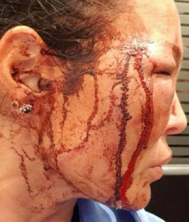 Denuncian a exbasquetbolista profesional por golpear a su exnovia - 1559836500-064928-1559836879-sumario-normal