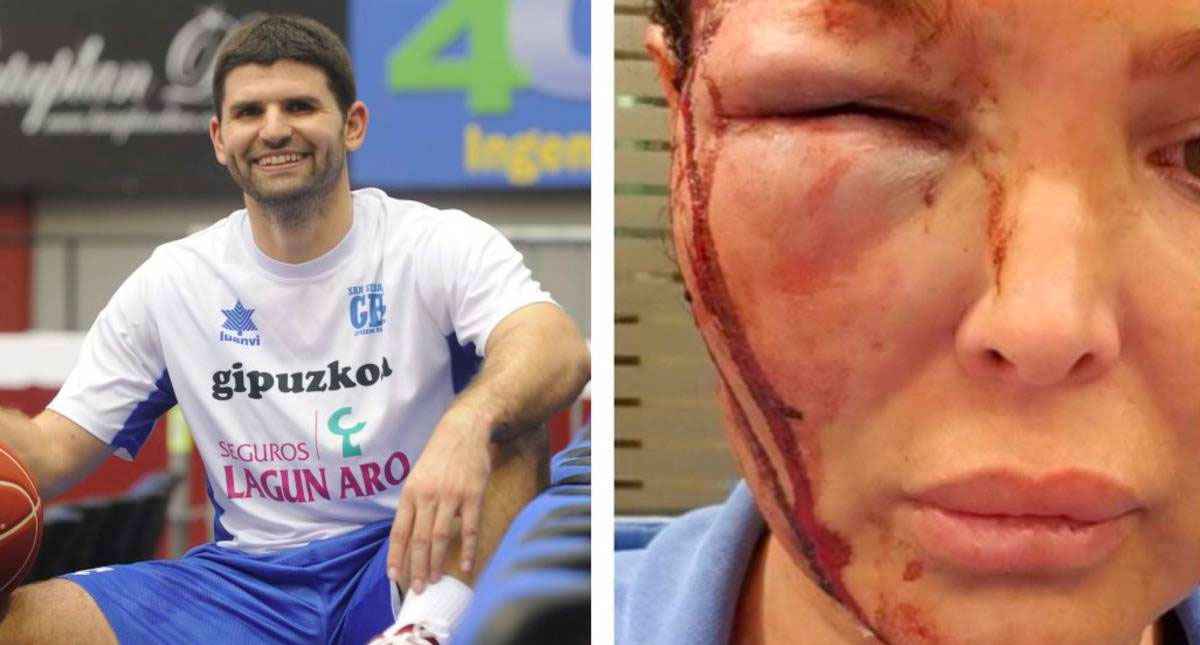 Denuncian a exbasquetbolista profesional por golpear a su exnovia