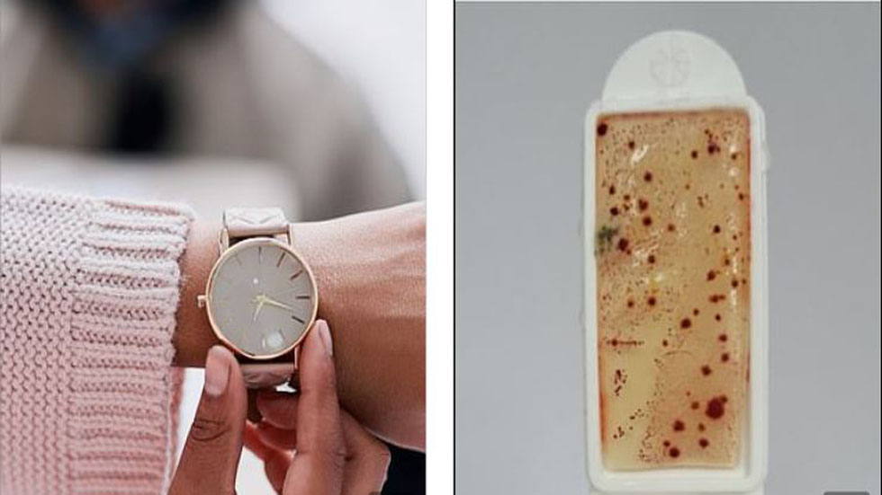Relojes albergan ocho veces más suciedad que baños - bacterias-de-un-reloj-de-mujer