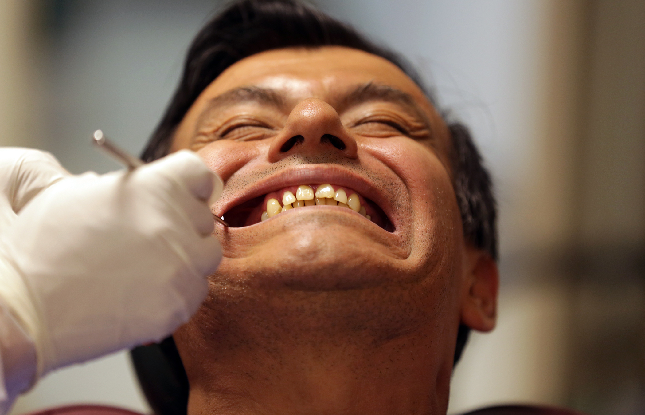 Rechinar los dientes puede ocasionar su caída prematura - foto-2