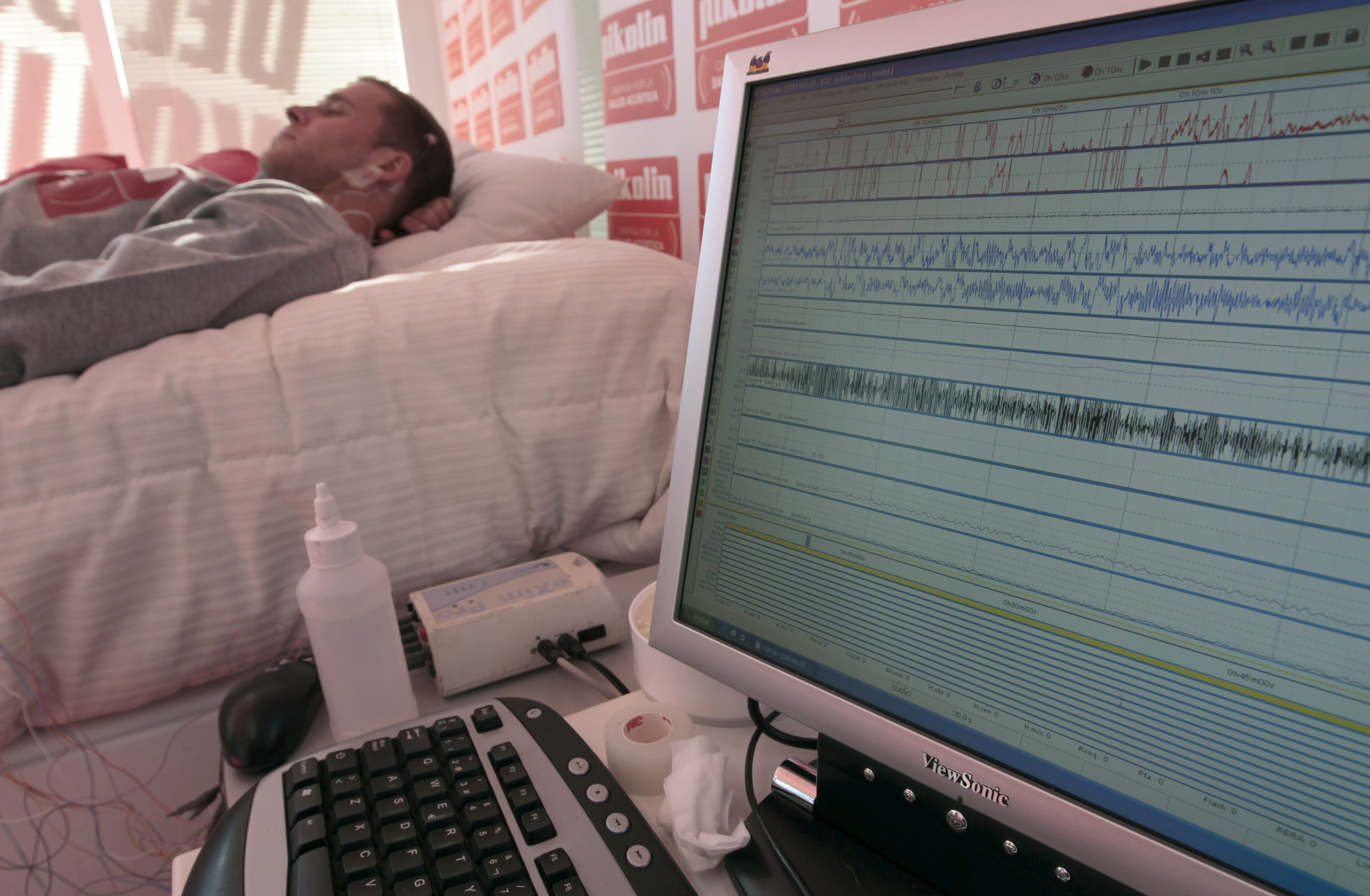 Pocas horas de sueño y estrés afectan la fertilidad masculina