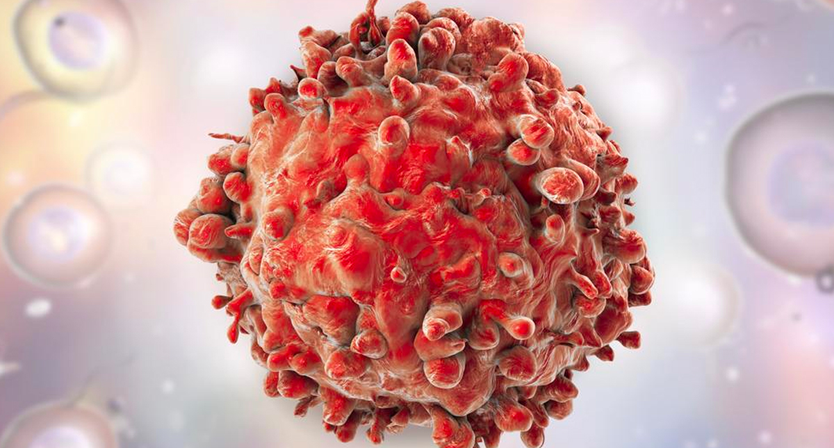 Nueva terapia podría tratar cinco tipos de cáncer