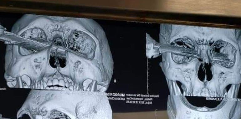 #Video Hombre pierde ojo durante riña en estacionamiento de Veracruz - cuchillo-veracruz