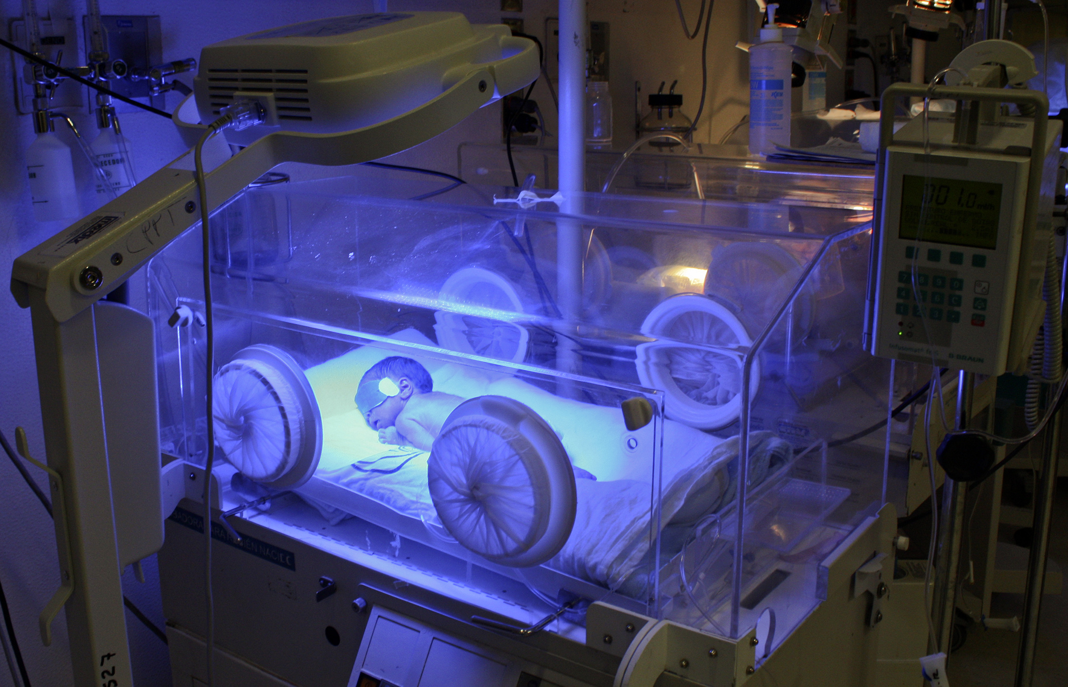 IMSS brinda atención especializada a recién nacidos con bajo peso - umae-gineco-trillizos