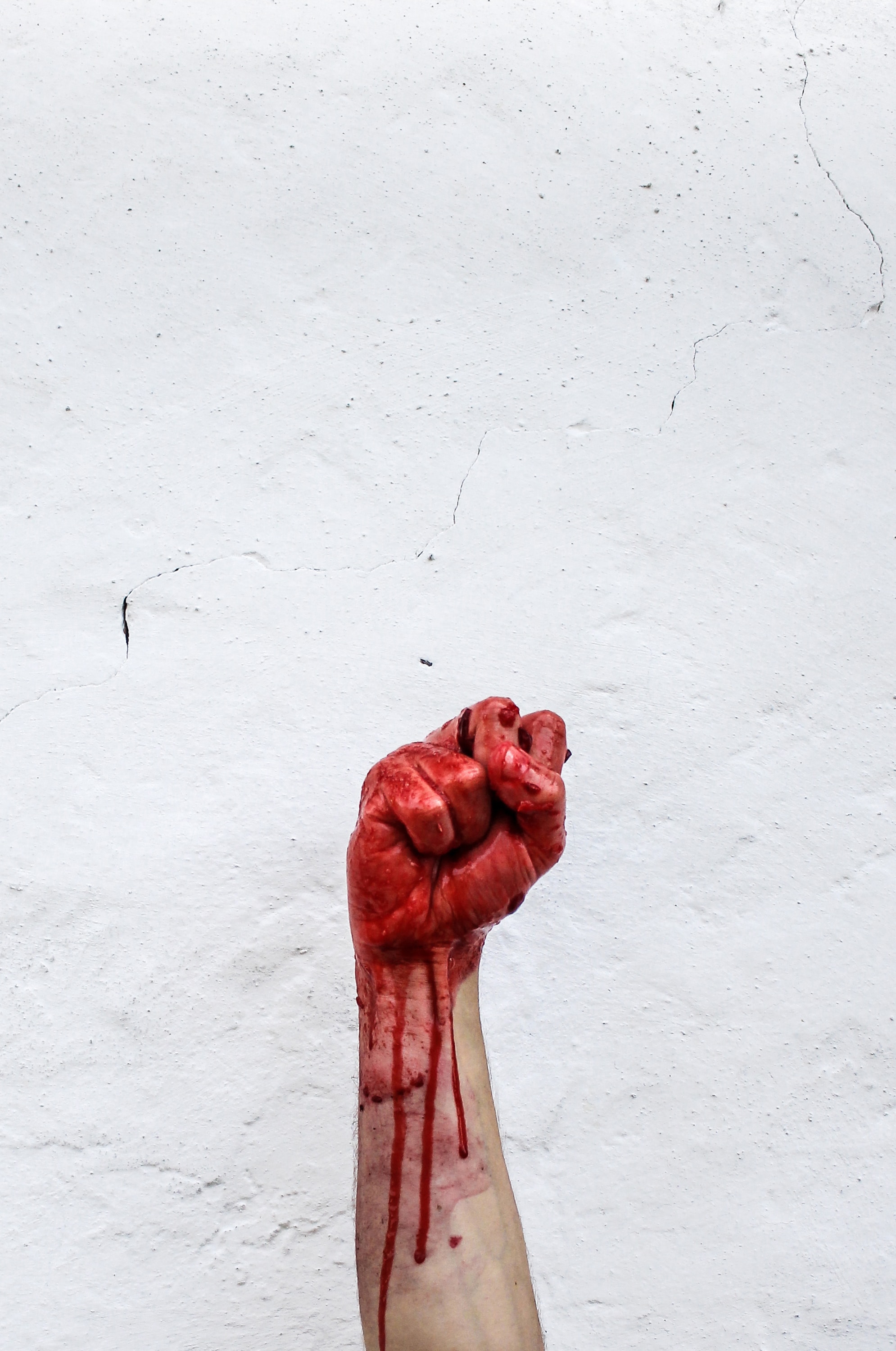 La hemofilia, el miedo a vivir siempre con el peligro de las hemorragias