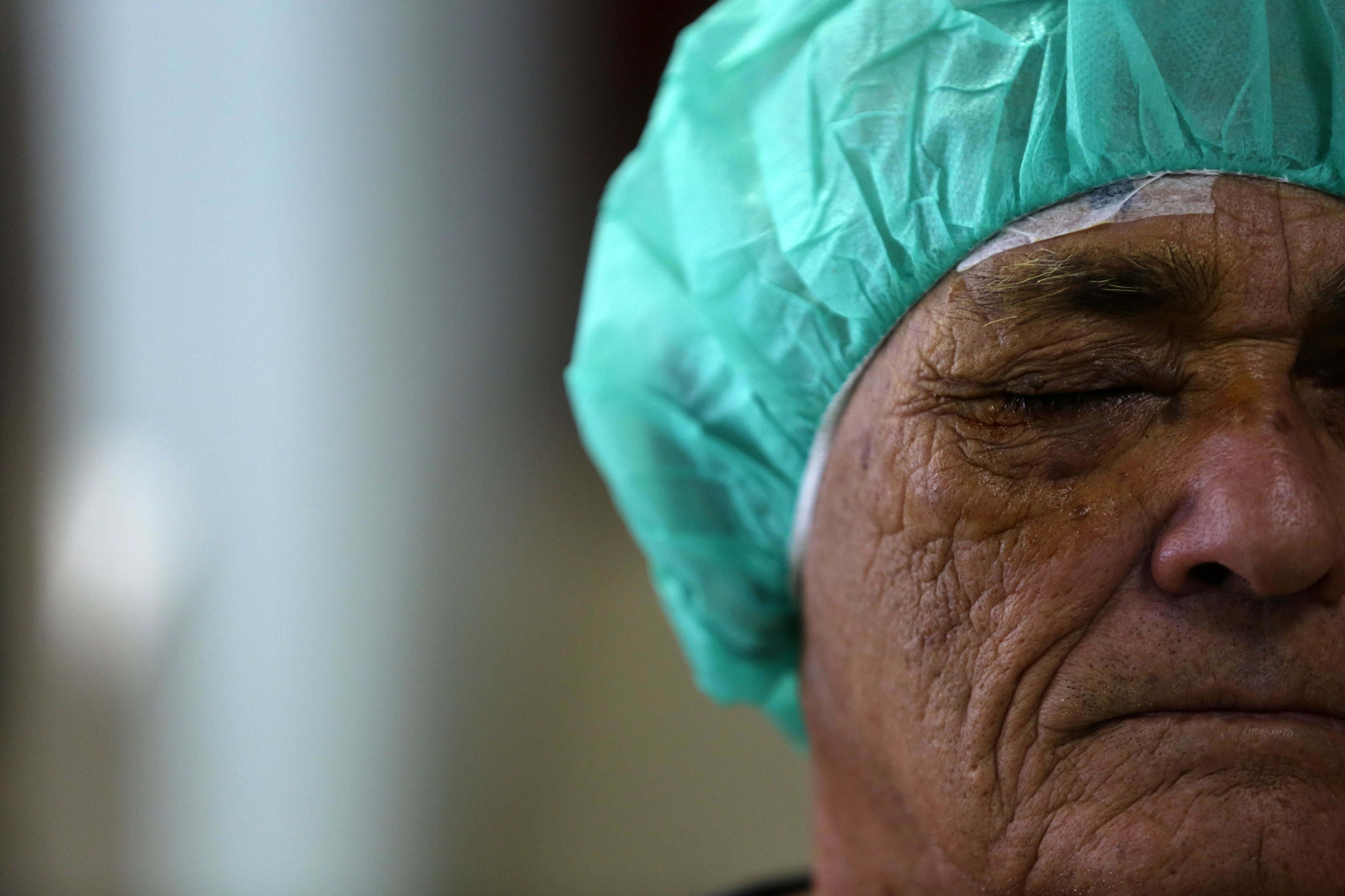 La mitad de los adultos mayores tienen cataratas que pueden provocar ceguera