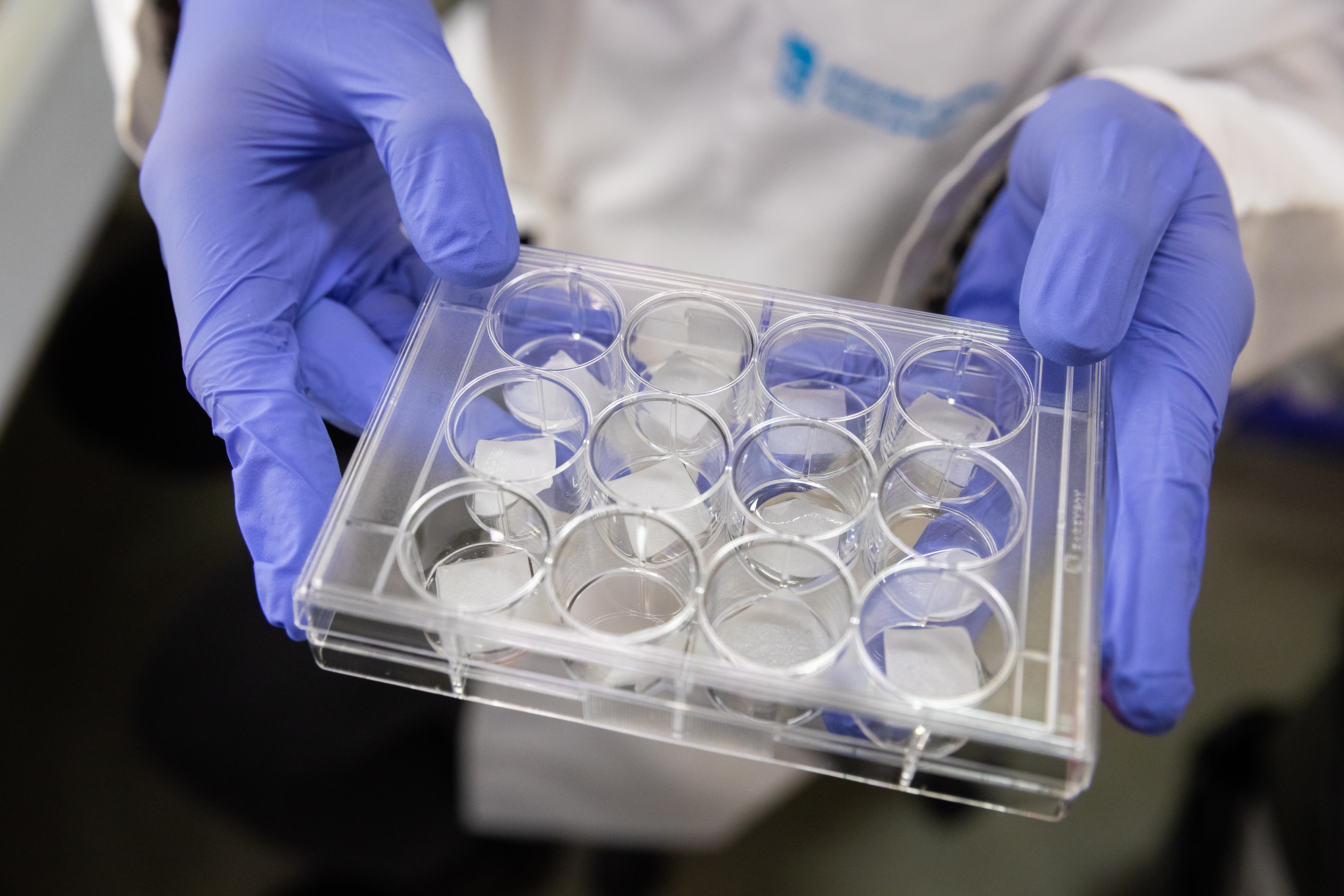 Identifican nueva forma de eliminar células cancerígenas