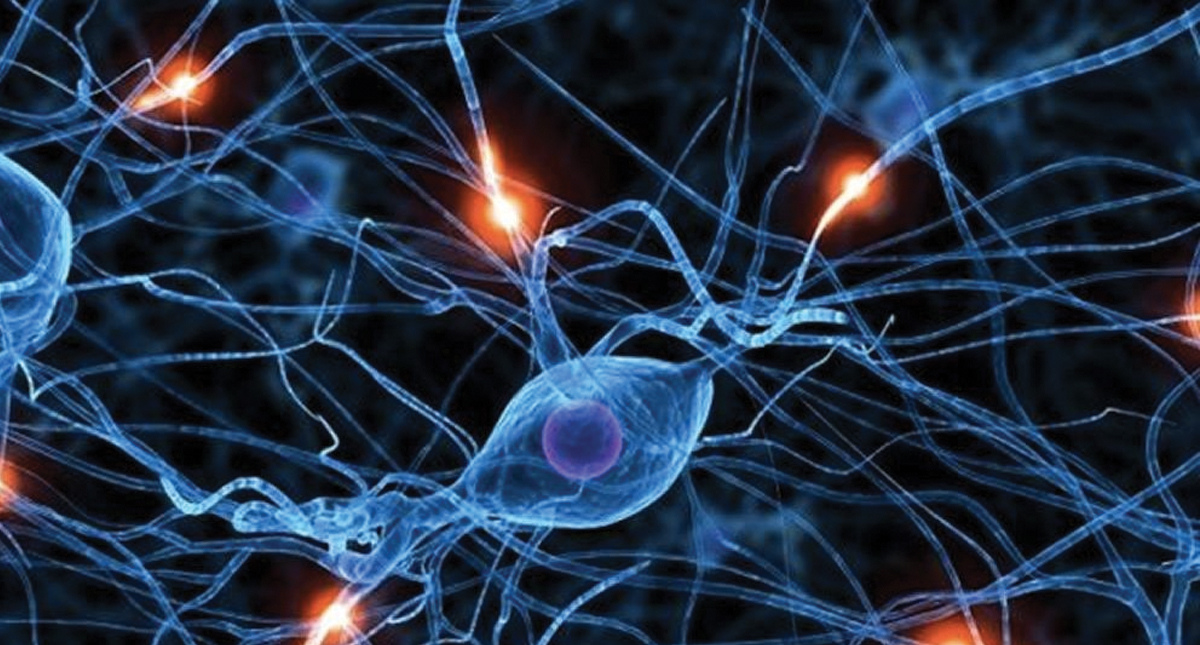 Tratan con terapia, medicamentos y cirugía a pacientes con enfermedad de Huntington