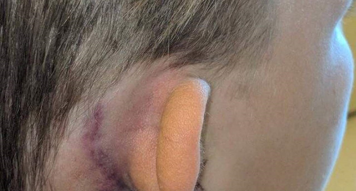 Hombre golpea a menor por ‘faltarle el respeto’ al himno de EE.UU.