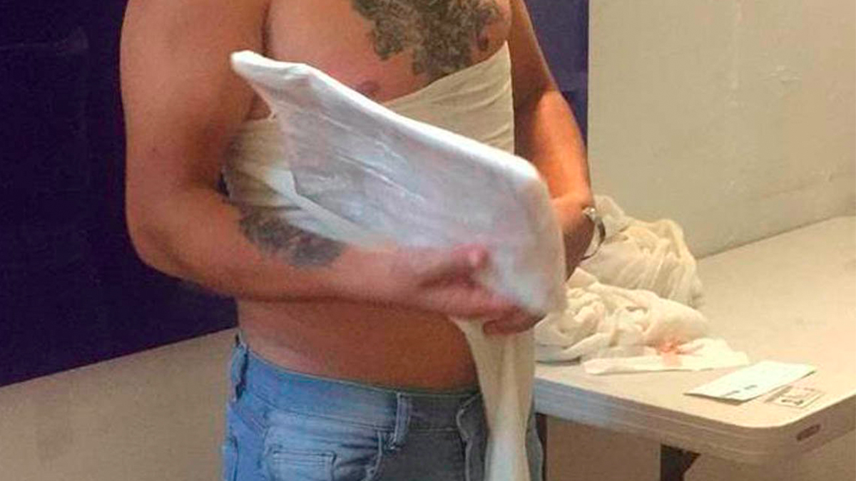 Detienen a hombre con heroína pegada en su espalda en Tijuana