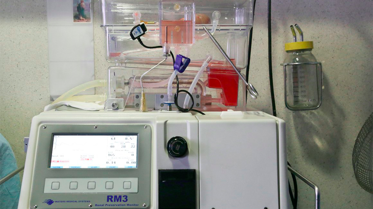 Máquina permite al IMSS conservar riñones fuera de un cuerpo