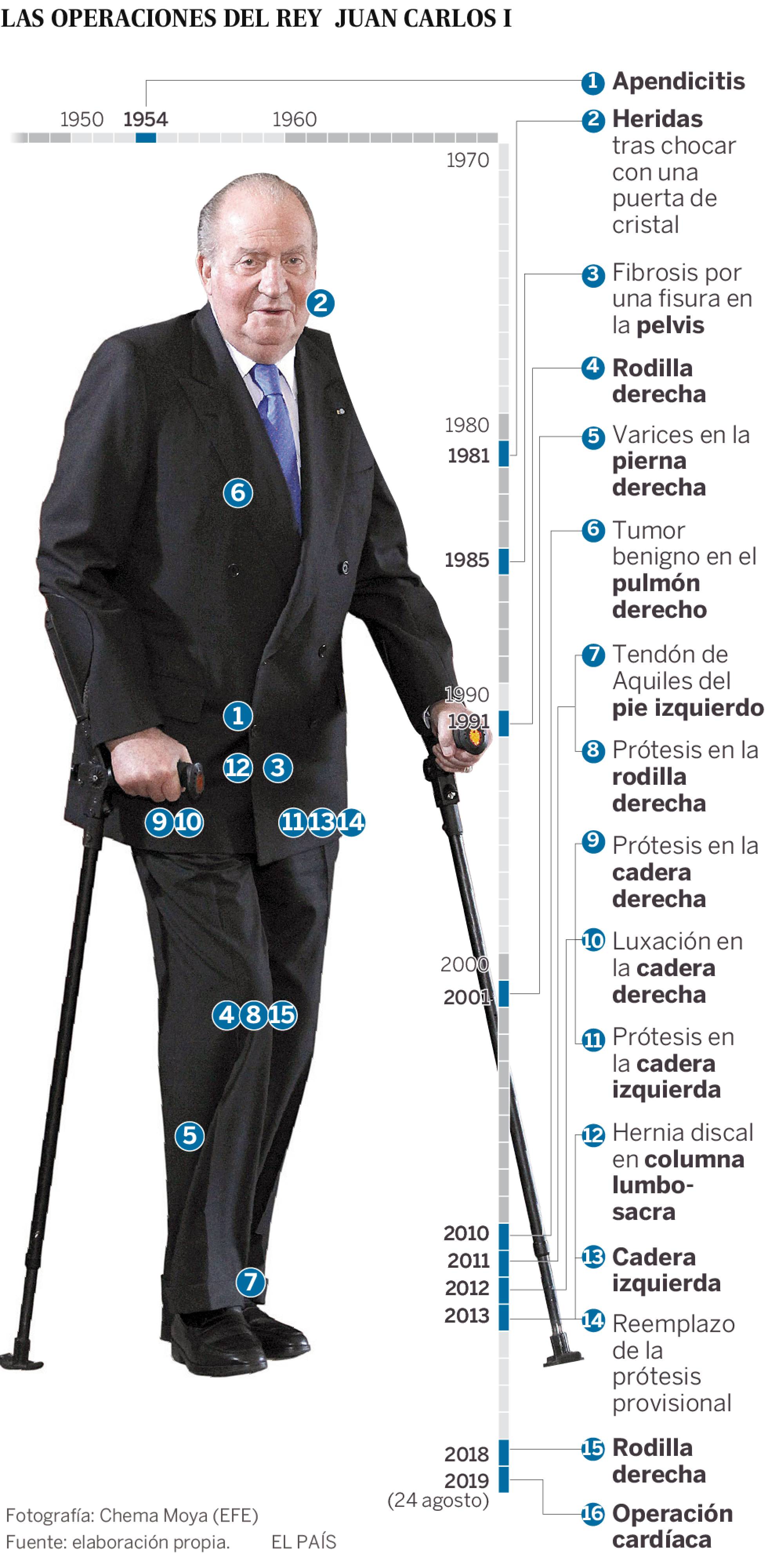 Operarán del corazón al rey emérito Juan Carlos de España - operaciones-del-rey-de-espana